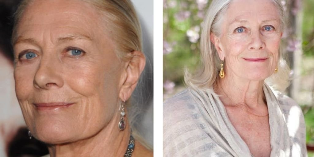 Vanessa Redgrave
