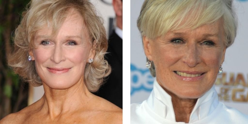 Glenn Close